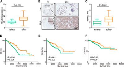 PSME2 identifies immune-hot tumors in breast cancer and associates with well therapeutic response to immunotherapy